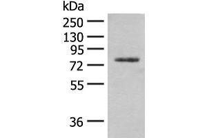 Western blot analysis of Hela cell lysate using TRMT1 Polyclonal Antibody at dilution of 1:300