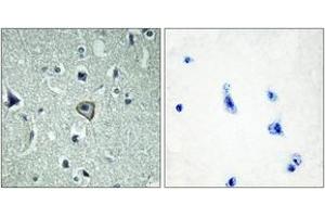 Immunohistochemistry analysis of paraffin-embedded human brain tissue, using BAI2 Antibody. (BAI2 抗体  (AA 91-140))