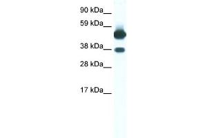 WB Suggested Anti-THRB Antibody Titration:  0. (THRB 抗体  (N-Term))