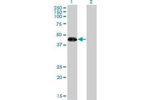 Western Blot analysis of ZNF3 expression in transfected 293T cell line by ZNF3 monoclonal antibody (M08), clone 1F7. (ZNF3 抗体  (AA 1-110))