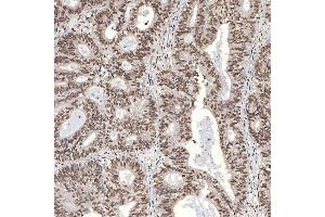 IHC analysis of U1A/SNRPA using anti-U1A/SNRPA antibody (ABIN7600891). (SNRPA1 抗体  (AA 25-218))