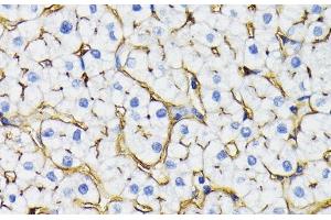 Immunohistochemistry of paraffin-embedded Human liver using NT5E / CD73 Polyclonal Antibody at dilution of 1:200 (40x lens). (CD73 抗体)