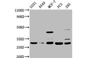 Western Blot Positive WB detected in: U251 whole cell lysate, A549 whole cell lysate, MCF-7 whole cell lysate, PC-3 whole cell lysate, 293 whole cell lysate All lanes: REEP4 antibody at 1:1500 Secondary Goat polyclonal to rabbit IgG at 1/50000 dilution Predicted band size: 30, 20 kDa Observed band size: 30 kDa (Receptor Accessory Protein 4 抗体  (AA 78-257))