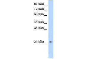 FERD3L antibody (20R-1112) used at 0. (FERD3L 抗体  (N-Term))