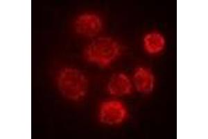 Immunofluorescent analysis of SBP-2 staining in Hela cells. (SECISBP2 抗体)
