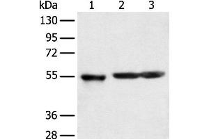 Western blot analysis of Human cerebrum tissue rat brain tissue and Mouse brain tissue using KCTD16 Polyclonal Antibody at dilution of 1:350 (KCTD16 抗体)