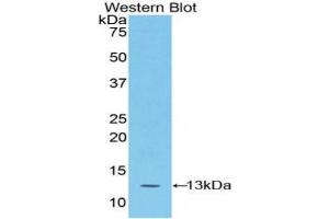 Detection of Recombinant S100A4, Mouse using Polyclonal Antibody to S100 Calcium Binding Protein A4 (S100A4) (s100a4 抗体  (AA 1-101))