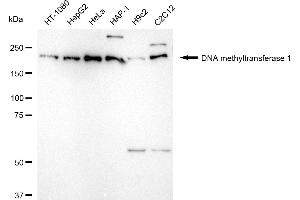 Western blotting analysis using DNA methyltransferase 1 antibody (ABIN7798362). (Recombinant DNMT1 抗体)