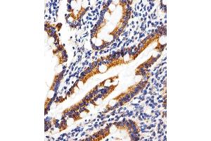 Immunohistochemical analysis of paraffin-embedded H. (SHB 抗体  (AA 250-290))