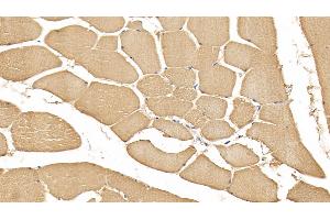 Detection of RNLS in Human Skeletal muscle Tissue using Monoclonal Antibody to Renalase (RNLS) (RNLS 抗体  (AA 18-342))