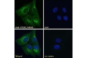Immunofluorescence (IF) image for anti-Vacuolar Protein Sorting 35 (VPS35) (C-Term) antibody (ABIN185182)