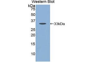 Western Blotting (WB) image for anti-Cathepsin K (CTSK) (AA 54-317) antibody (ABIN1858553) (Cathepsin K 抗体  (AA 54-317))