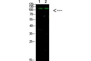Western Blot analysis of 1, Mouse-liver 2, hela cells using primary antibody diluted at 1:1000 (4 °C overnight). (GLI1 抗体  (AA 460-490))