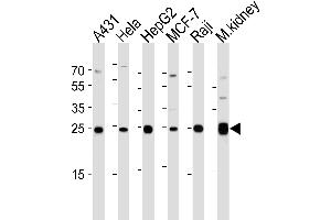 Western blot analysis of lysates from A431, Hela, HepG2, MCF-7, Raji cell line and mouse kidney tissue lysate (from left to right), using AK4 Antibody (Center) (ABIN1944856 and ABIN2838526). (AK4 抗体  (AA 119-153))