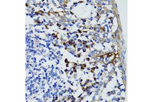 Immunohistochemistry of paraffin-embedded human tonsil using USO1 antibody (ABIN1875291) at dilution of 1:100 (40x lens). (USO1 抗体)