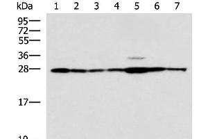 Western blot analysis of Rat liver tissue Mouse kidney tissue Mouse lung tissue HUVEC Jurkat Hela HepG2 cell lysates using RPL10A Polyclonal Antibody at dilution of 1:700 (RPL10A 抗体)