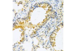 Immunohistochemistry of paraffin-embedded mouse lung using IL20 antibody at dilution of 1:100 (40x lens). (IL-20 抗体)
