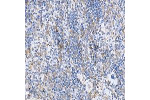 Immunohistochemistry of paraffin-embedded mouse spleen using SOCS1 Rabbit pAb (ABIN6128737, ABIN6148263, ABIN6148266 and ABIN6223700) at dilution of 1:250 (40x lens).