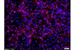 Formalin-fixed and paraffin embedded mouse melanoma labeled with Anti- MITF Polyclonal Antibody, Unconjugated (ABIN676373) at 1:200 followed by conjugation to the secondary antibody Goat Anti-Rabbit IgG, PE conjugated used at 1:200 dilution for 40 minutes at 37°C and DAPI (MITF 抗体  (AA 351-450))