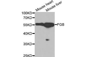 Western blot analysis of extracts of various tissues, using FGB antibody. (Fibrinogen beta Chain 抗体  (AA 202-491))