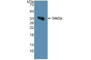 Detection of Recombinant GP1Ba, Human using Polyclonal Antibody to Cluster Of Differentiation 42b (CD42b) (CD42b 抗体  (AA 19-291))