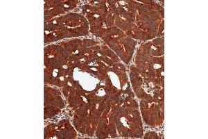 Immunohistochemistry (Paraffin-embedded Sections) (IHC (p)) image for anti-Dual Specificity Phosphatase 6 (DUSP6) (AA 58-89) antibody (ABIN392864)