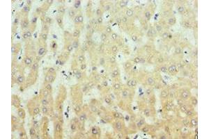 Immunohistochemistry of paraffin-embedded human liver tissue using ABIN7156335 at dilution of 1:100 (IRS1 抗体  (AA 1-160))