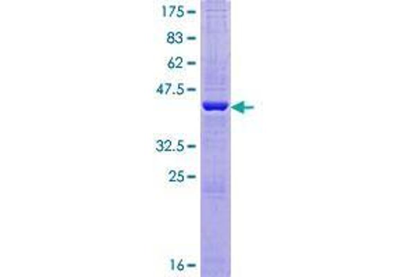 AGR3 Protein (AA 1-166) (GST tag)