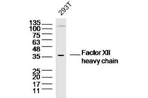 Human 293T cells probed with Factor XII heavy chain Polyclonal Antibody, unconjugated  at 1:300 overnight at 4°C followed by a conjugated secondary antibody at 1:10000 for 90 minutes at 37°C.