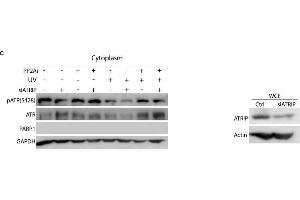 Protein phosphatase 2A (PP2A) dephosphorylates cytoplasmic pATR (S428) in a UV dose- and recovery time-dependent manner and is independent of ATRIP. (ATRIP 抗体  (AA 1-260))