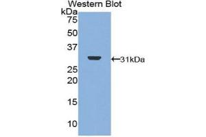 Western Blotting (WB) image for anti-DNA Topoisomerase II (TOP2) (AA 749-987) antibody (ABIN1860830) (TOP2 抗体  (AA 749-987))