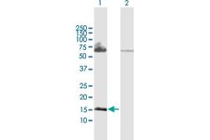 Western Blot analysis of PPP3R2 expression in transfected 293T cell line by PPP3R2 MaxPab polyclonal antibody. (Calcineurin B 抗体  (AA 1-173))
