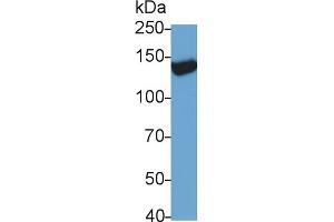Western Blotting (WB) image for anti-Transient Receptor Potential Cation Channel, Subfamily M, Member 4 (TRPM4) (AA 1-400) antibody (ABIN7427165)