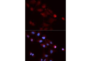 Immunofluorescence analysis of U2OS cells using SNRPE antibody (ABIN5973198). (SNRPE 抗体)