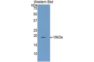 Western blot analysis of the recombinant protein. (ALOX15 抗体  (AA 170-312))