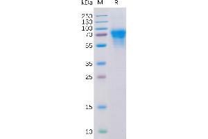 Human CD46 Protein, His Tag on SDS-PAGE under reducing condition.