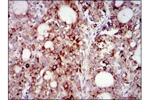 Immunofluorescence (IF) image for anti-Phosphoinositide 3 Kinase, p85 alpha (PI3K p85a) (AA 159-388) antibody (ABIN1844692)