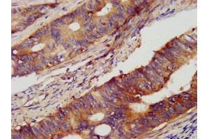 Immunohistochemistry (IHC) image for anti-Proprotein Convertase Subtilisin/kexin Type 2 (PCSK2) (AA 267-391) antibody (ABIN7161261)