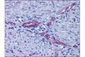 Immunohistochemistry (Paraffin-embedded Sections) (IHC (p)) image for anti-Prostaglandin E Receptor 2 (Subtype EP2), 53kDa (PTGER2) (C-Term) antibody (ABIN784590)
