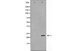 Western blot analysis on HeLa cell lysate using DIRA1 Antibody,The lane on the left is treated with the antigen-specific peptide.