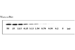 Image no. 5 for Epidermal Growth Factor Receptor (EGFR) ELISA Kit (ABIN625221)