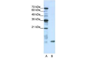 C14ORF156 antibody used at 0. (SLIRP 抗体  (N-Term))
