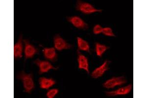 ABIN6272430 staining Hela by IF/ICC. (SH3BGR 抗体  (Internal Region))