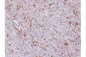 IHC-P Image Immunohistochemical analysis of paraffin-embedded U87 xenograft , using Trehalase, antibody at 1:100 dilution. (TREH 抗体)