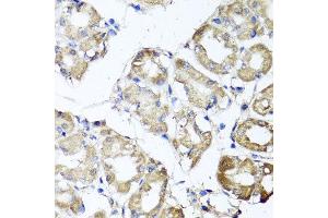 Immunohistochemistry of paraffin-embedded human gastric using MGAT1 antibody at dilution of 1:100 (x40 lens). (MGAT1 抗体)