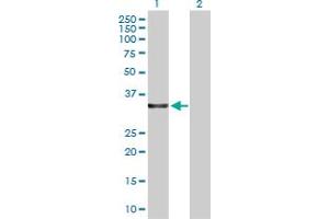 Western Blot analysis of LDHA expression in transfected 293T cell line by LDHA MaxPab polyclonal antibody. (Lactate Dehydrogenase A 抗体  (AA 1-332))