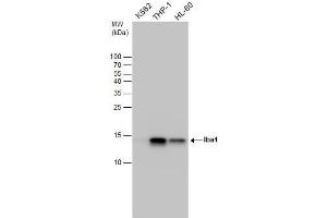 WB Image Iba1 antibody detects Iba1 protein by western blot analysis. (Iba1 抗体)