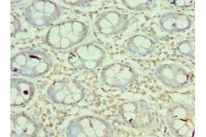 Immunohistochemistry of paraffin-embedded human colon tissue using ABIN7160218 at dilution of 1:100 (MORF4L1 抗体  (AA 1-100))