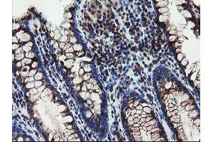 Immunohistochemical staining of paraffin-embedded Human colon tissue using anti-DPH2 mouse monoclonal antibody. (DPH2 抗体)