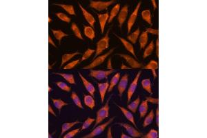 Immunofluorescence analysis of L929 cells using RP antibody (ABIN7270101) at dilution of 1:100. (RPAP3 抗体  (AA 17-241))